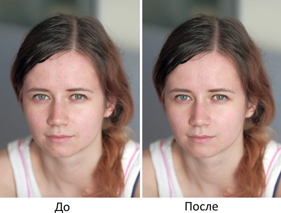 Обработка фото: Ретушь фото