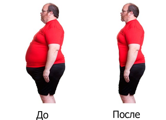 Пластика: пластика